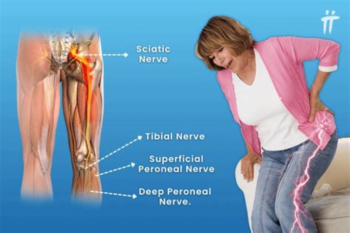 Is chamomile good for sciatica?