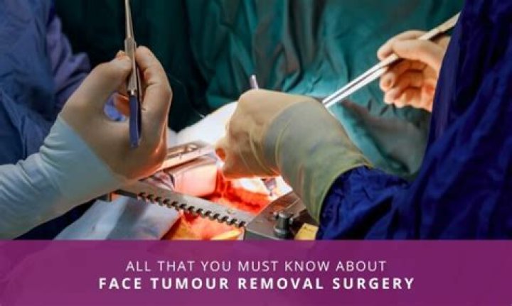 Is chemo necessary after tumor removal?