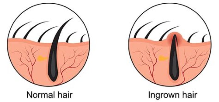 Is dying hair painful?