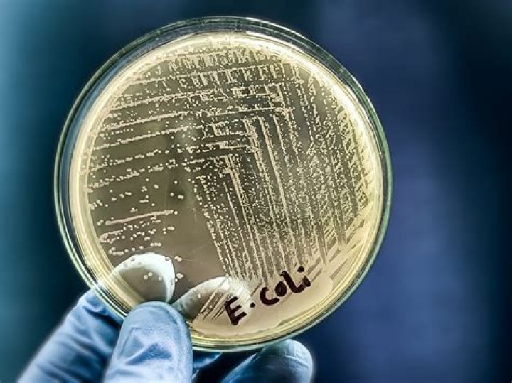 Is E. coli in urine serious?