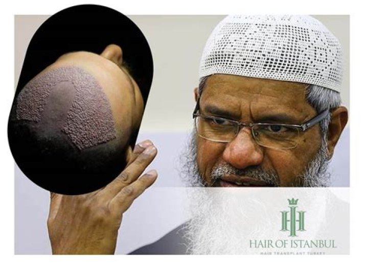 Is ethanol haram or halal?