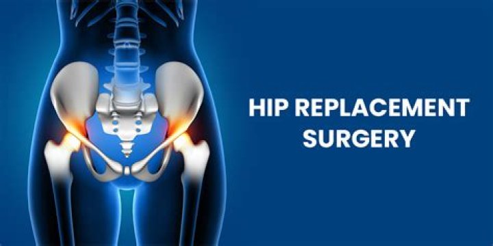 Is hip replacement a major operation?