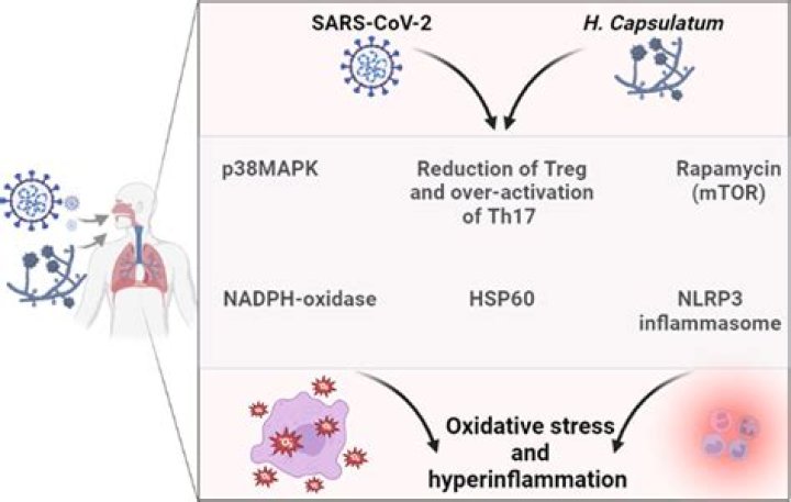 Is histoplasmosis related to Covid 19?