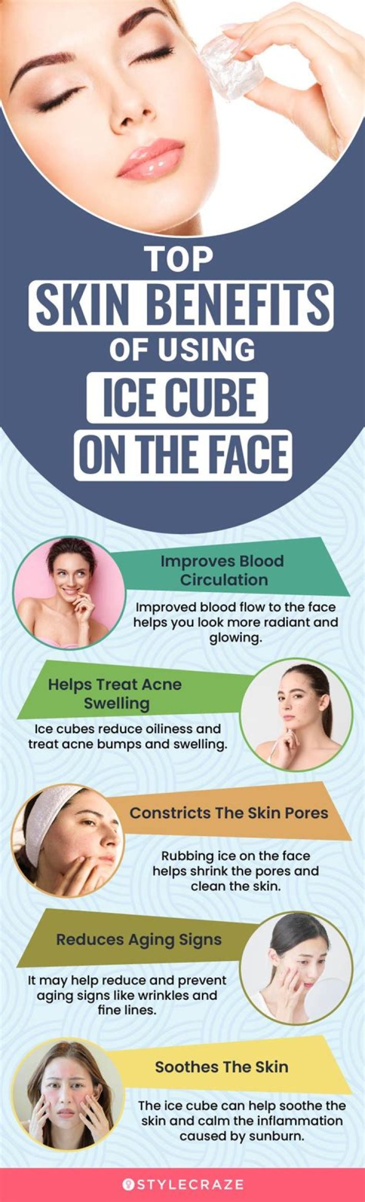 Is ice good for blackheads?
