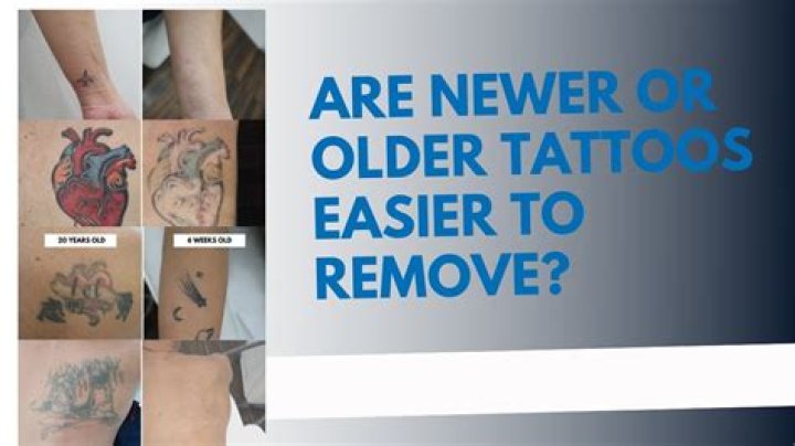 Is it easier to remove newer or older tattoos?
