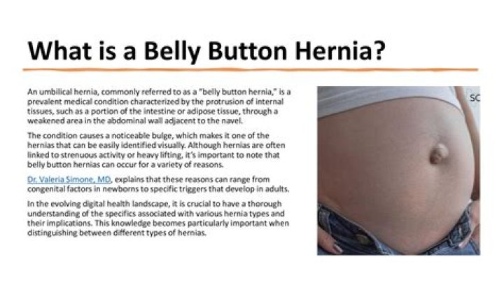 Is it normal to feel a lump in your belly button?
