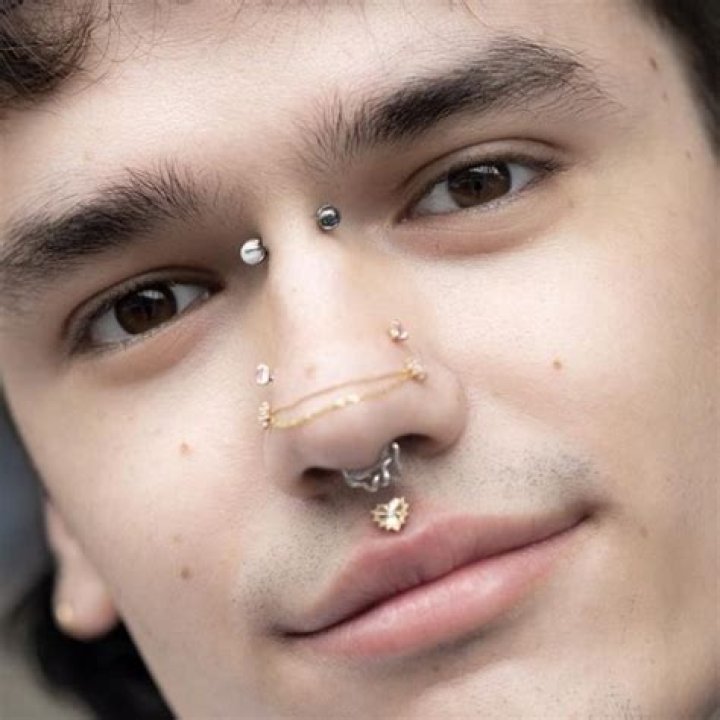 Is it weird to get a nose job?