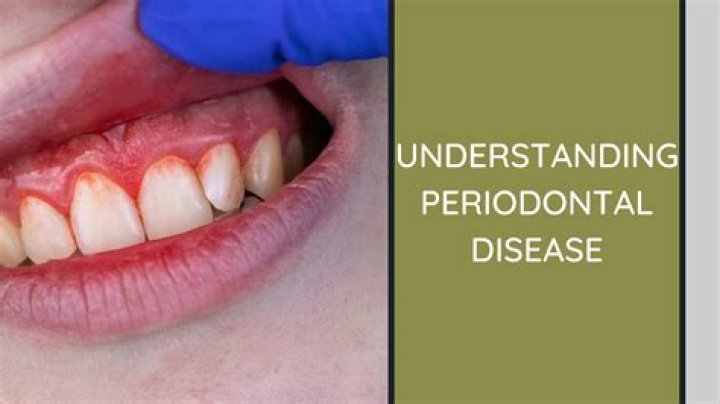 Is periodontal disease manageable?