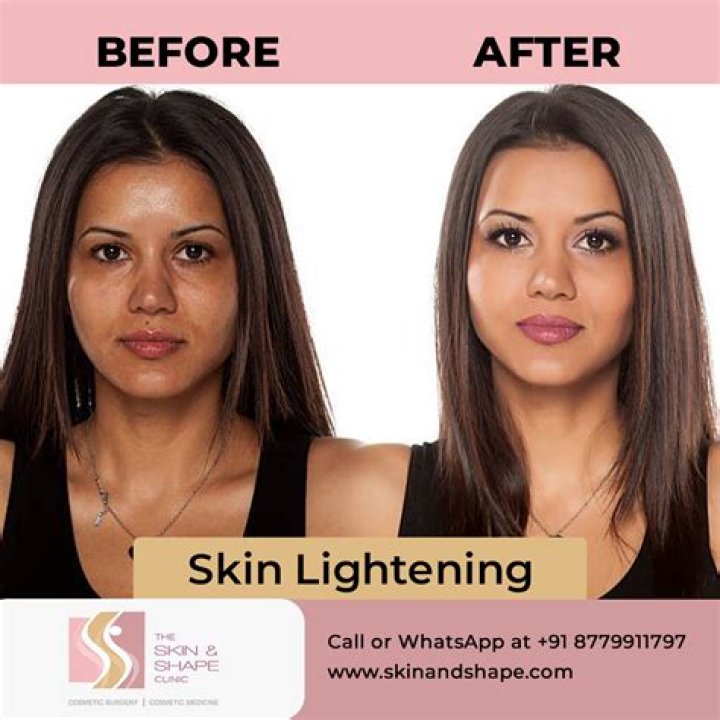 Is skin lightening same as bleaching?