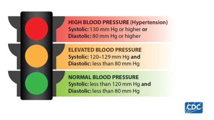Is systolic blood pressure a discrete variable?