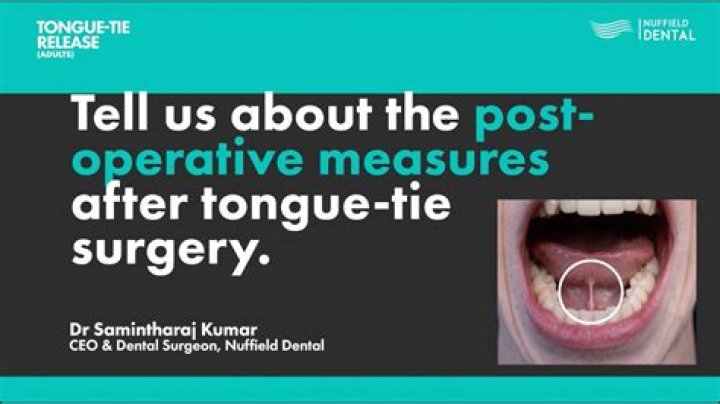 Is tongue-tie surgery painful?