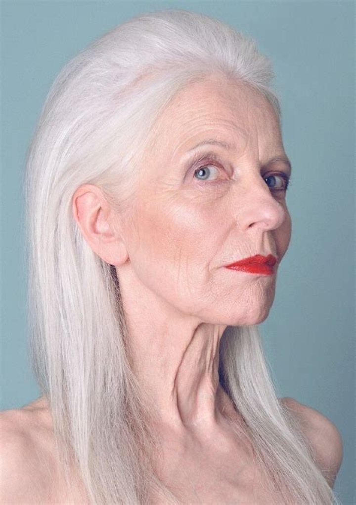 Is white hair normal at 18?