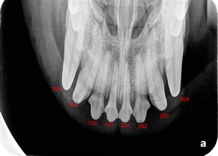 Is XRAY free in Canada?