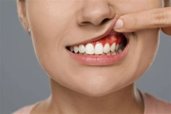 Should I chew gum after brushing?