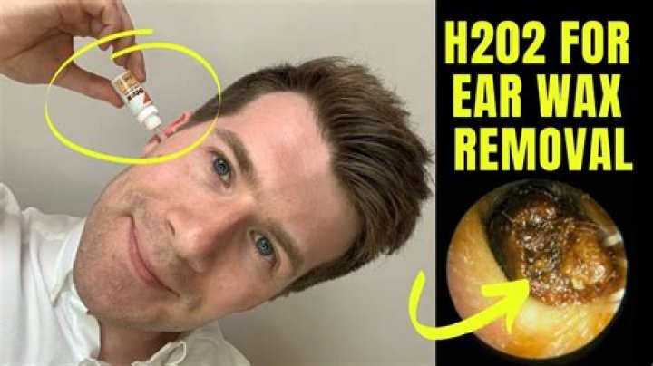 Should you remove earwax?