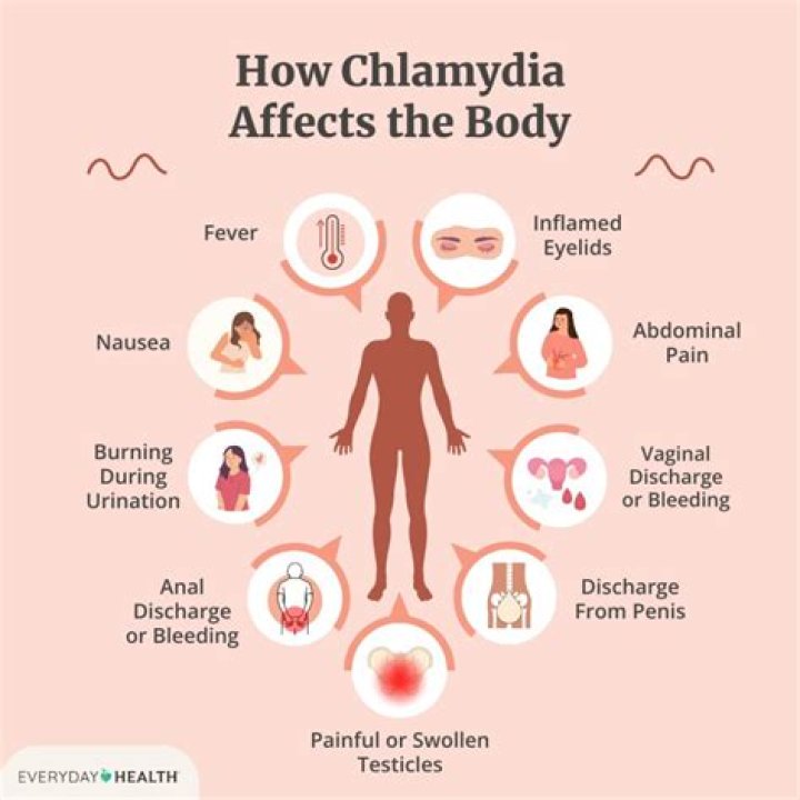 What are the long term effects of chlamydia?