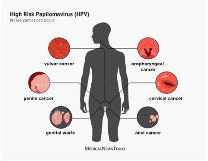 What are the signs of an HPV flare up?