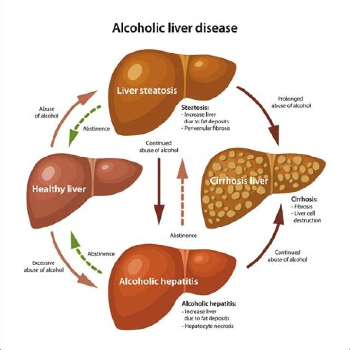 What are the signs of liver damage from alcohol?