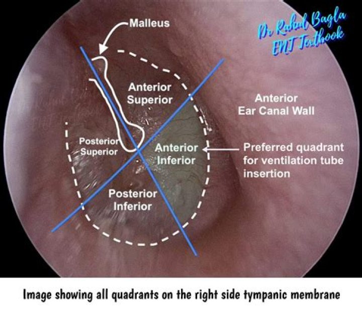 What are to tM and tP in PERT?