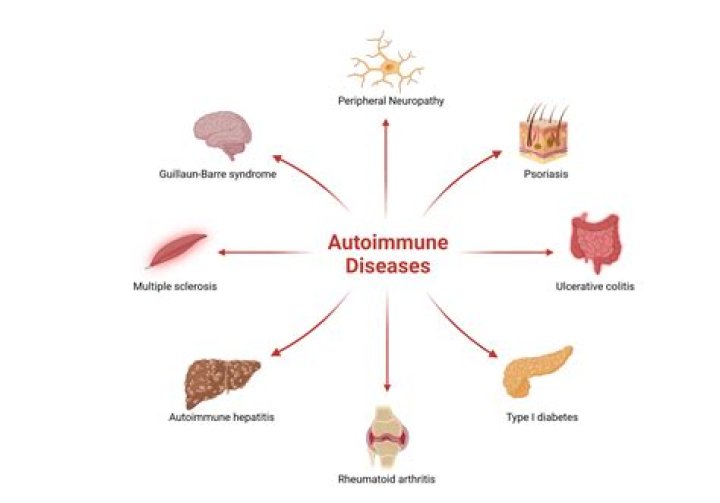 What autoimmune disease causes high cholesterol?