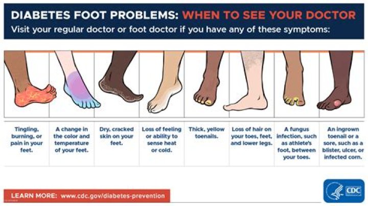 What can your feet tell you about your heart?