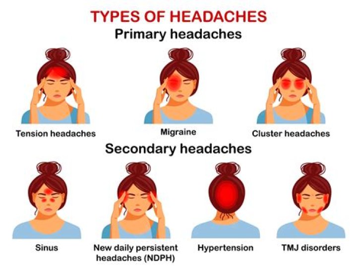 What causes headaches everyday in females?