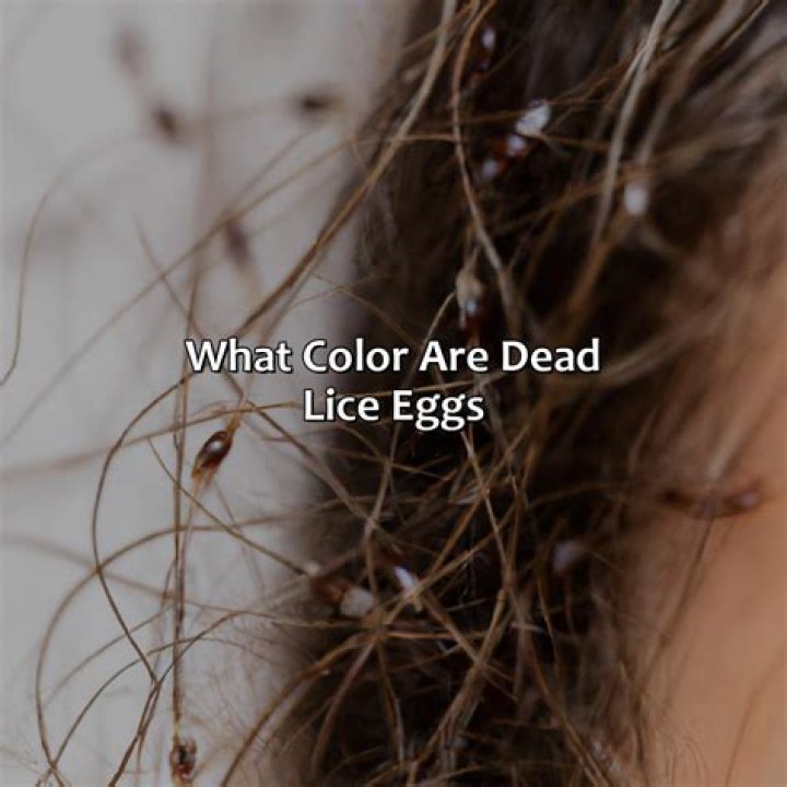 What color are dead lice eggs?