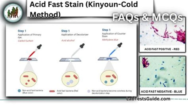 What color is acid-fast stain?