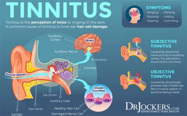 What diseases are associated with tinnitus?