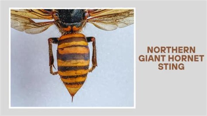 What do you do for ground hornet stings?