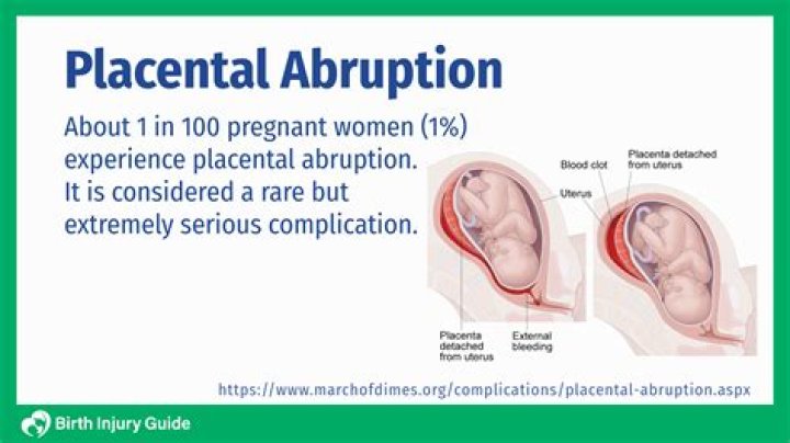 What do you do with placenta after birth?