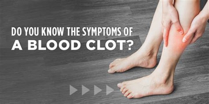 What does a blood clot in ankle feel like?