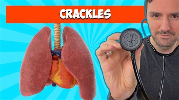 What does a crackle on the lung mean?