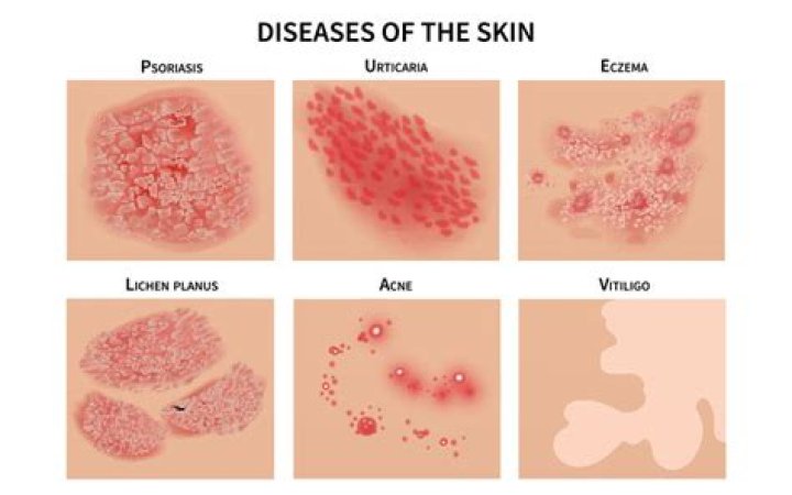 What does a skin infection look like?