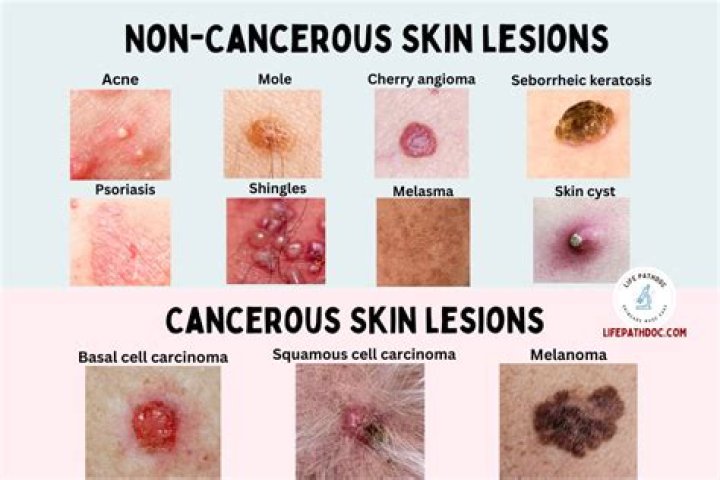 What does a suspicious skin lesion look like?