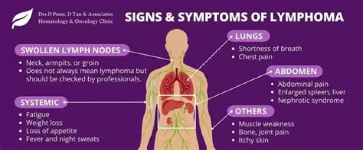 What does abdominal lymphoma feel like?