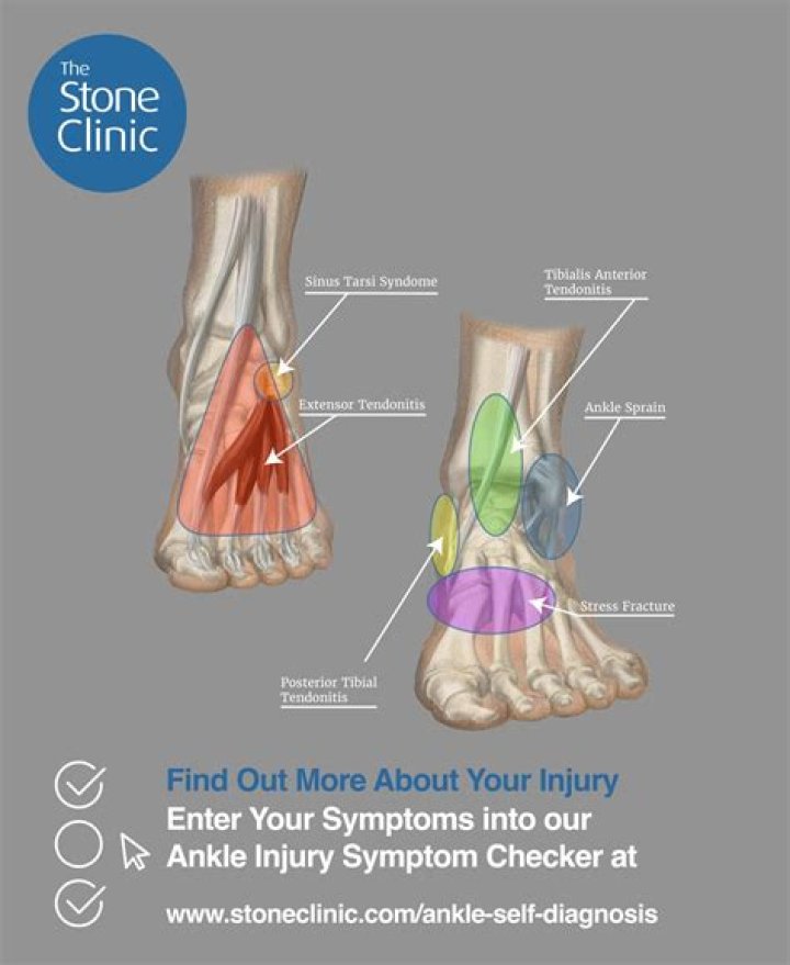 What does an anchor on the ankle mean?