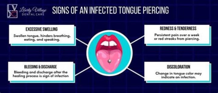 What does an infected tongue piercing look like?