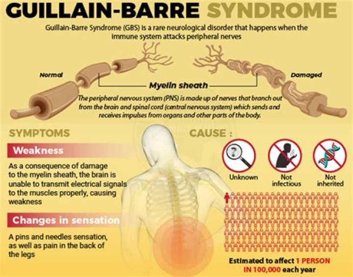 What does Guillain-Barre pain feel like?