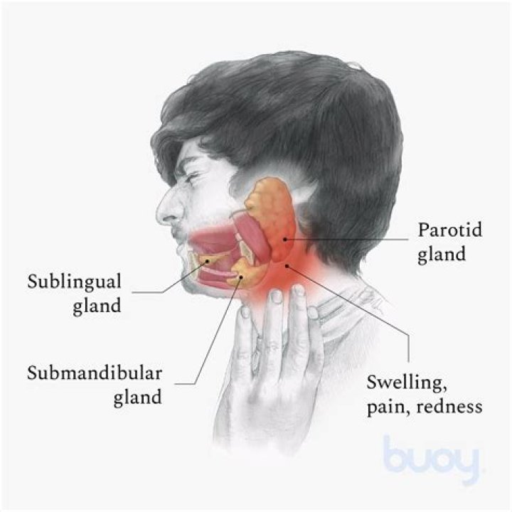 What does it mean when only one gland is swollen?