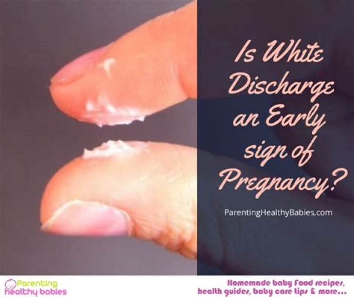 What does milky white discharge look like in early pregnancy?