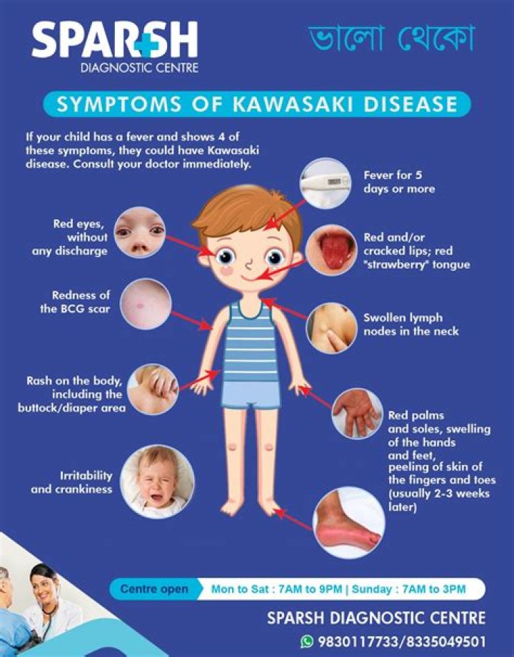 What does the rash look like for Kawasaki disease?