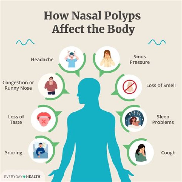 What foods to avoid if you have nasal polyps?