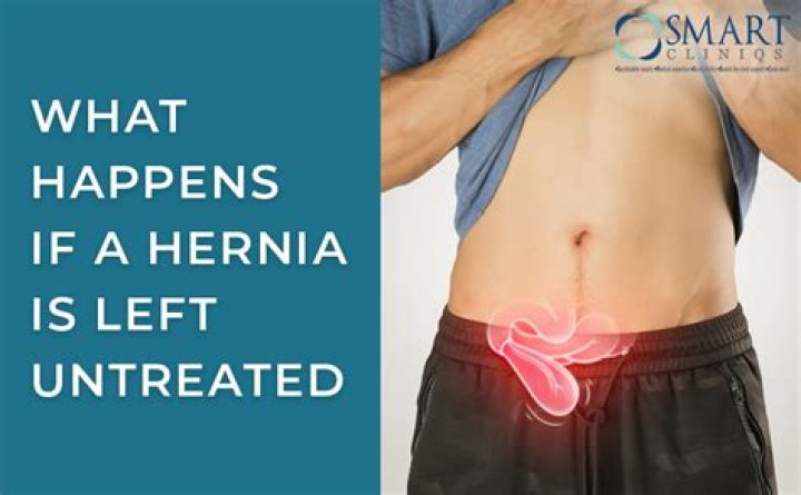What happens if trauma is left untreated?