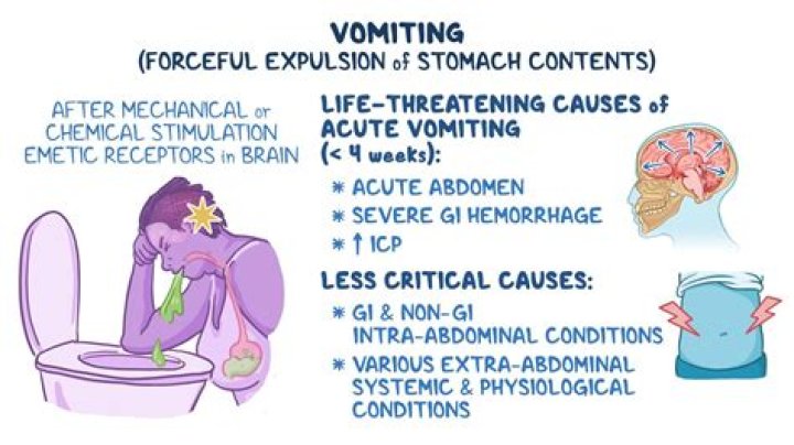 What happens if you vomit on a plane?
