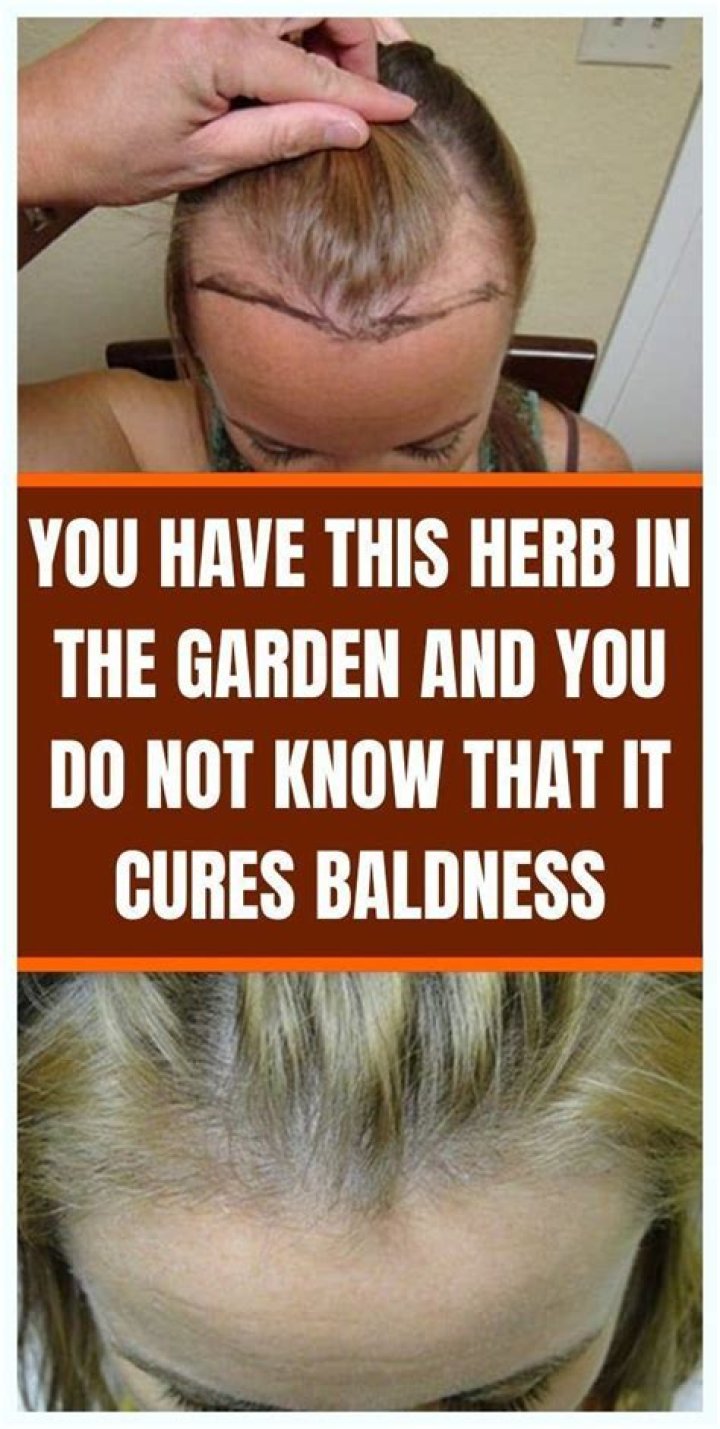 What herb cures baldness?