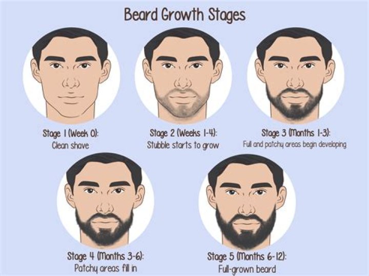 What is a female beard called?