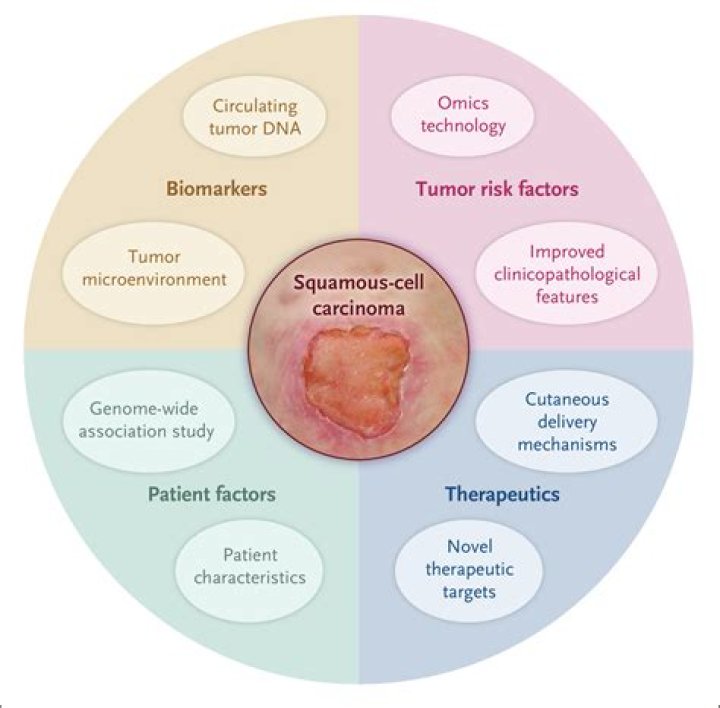 What is considered early treatment for squamous cell carcinoma?