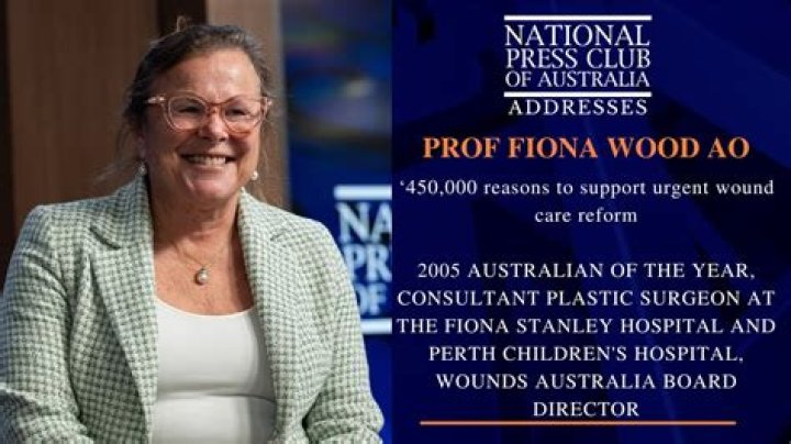 What is Fiona assignment?