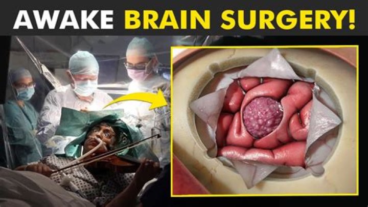 What is it like being awake for brain surgery?